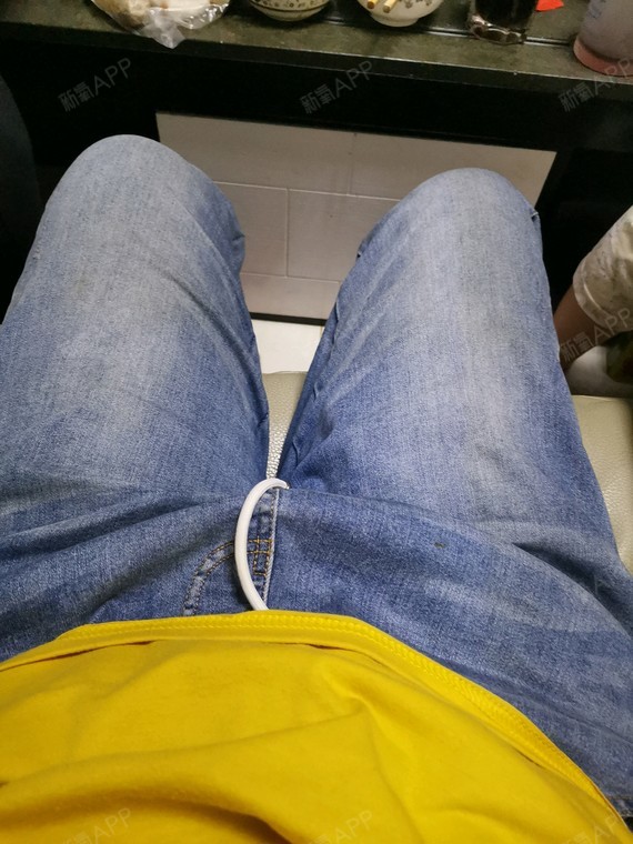 上厕所的时候看了一下,明显的一只腿粗一只腿细,纬度和昨天一