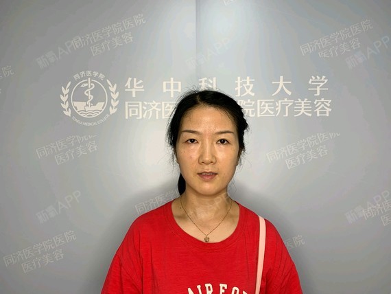 同济医院整形美容科主任（同济医院整形美容科主任简介） 同济医院整形美容科主任（同济医院整形美容科主任简介）《同济医院整形外科电话》 整形美容