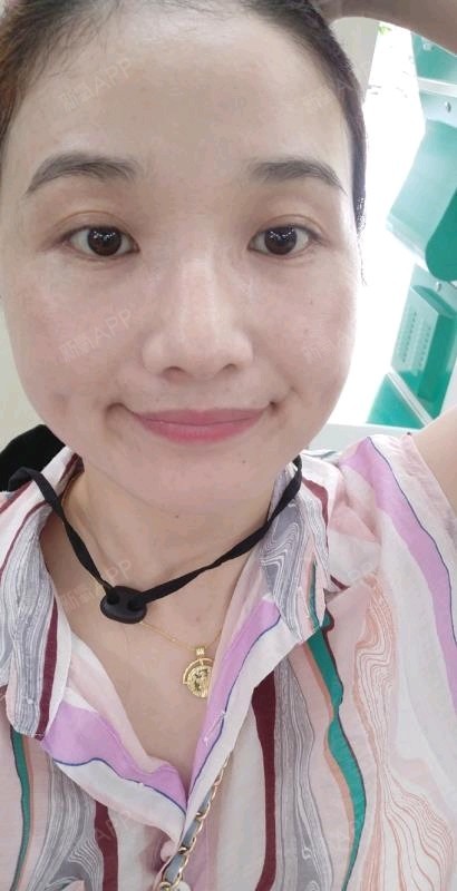 术后23天了,最近心情特备好,老是有朋友夸我皮肤很_圈子-新氧美容整形