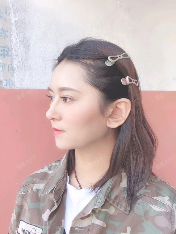 深圳耳软骨复合隆鼻好不好_效果图_a小鱼1耳软骨复合隆鼻术后第67天