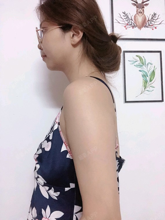 一直觉得自己是不是投错胎了,这胸平的,我本来应该投_圈子-新氧美容