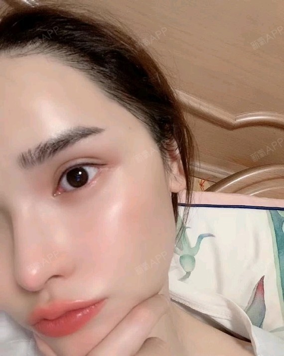 皮肤像是剥了壳的鸡蛋一样白里透红水嫩嫩的