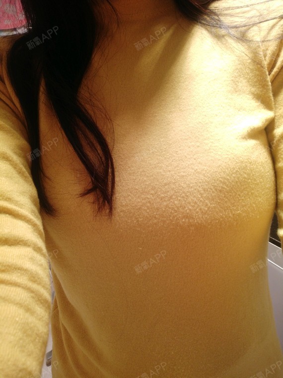 成都假体隆胸好不好_效果图_氧气5ra6m假体隆胸术后第21天_新氧美容