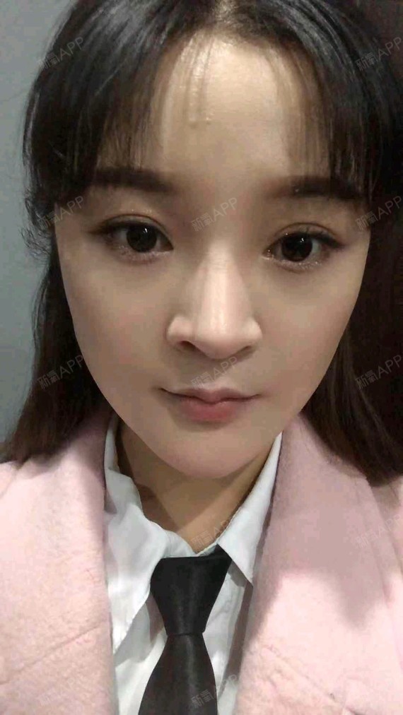 打完瘦脸针的第六天啦,还在等待术后效果,医生说打完_圈子-新氧美容