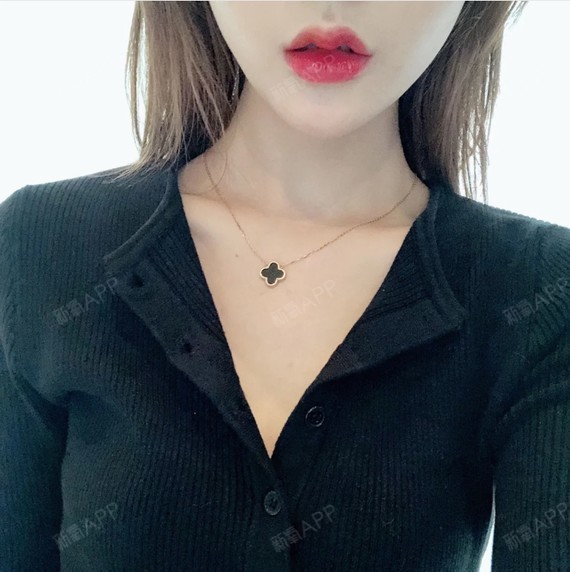 打的玻尿酸丰唇,嘟嘟嘴刚打完有点肿.不过形状很满意.