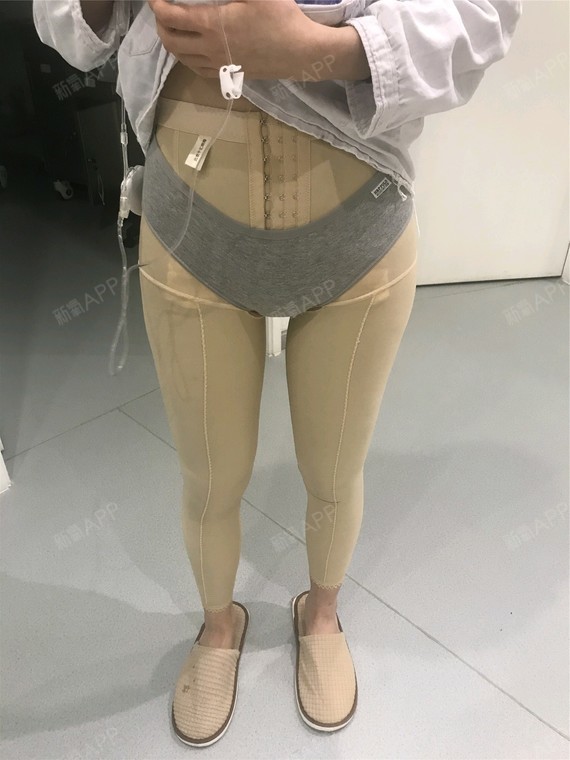 大腿根粗,屁股跟大腿根像连着的,分不清哪里开始是屁_圈子-新氧美容