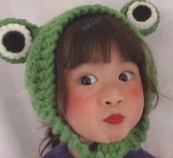 自体脂肪填充全脸