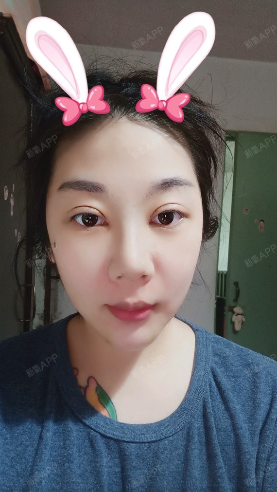 术后第十天