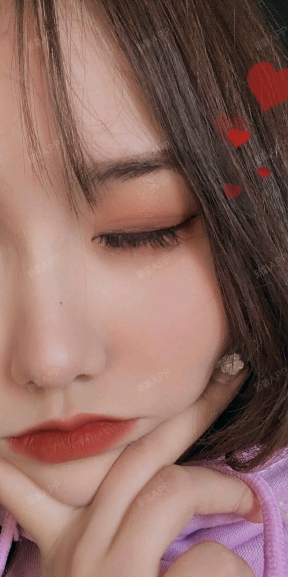 做完乳晕嫩红10天了,现在恢复的很好了,就是前两天_圈子-新氧美容整形