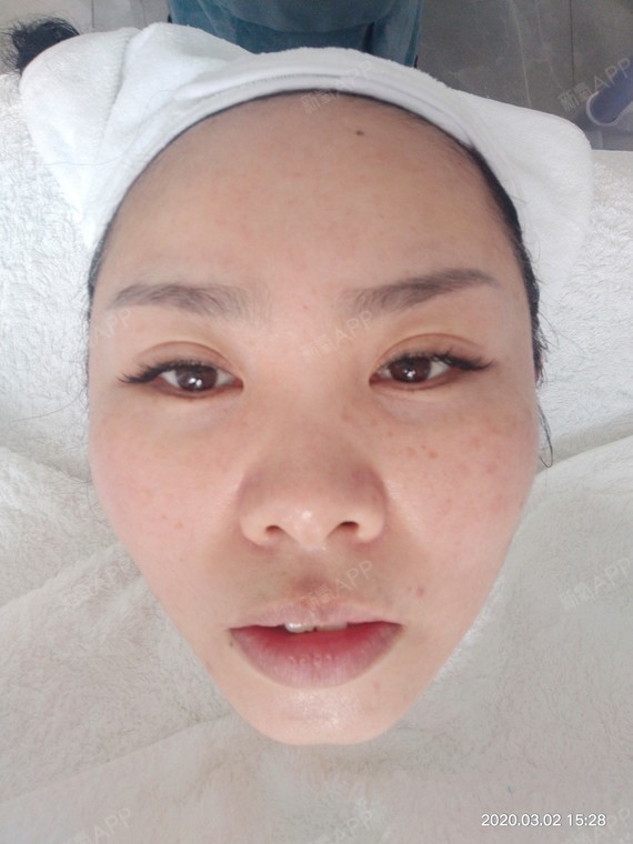 提前预约来凤凰晴身心美学中心来做光子嫩肤