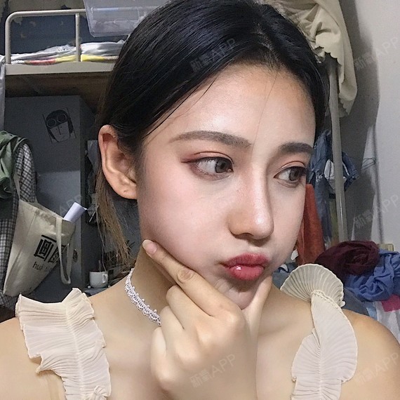 成都肋软骨隆鼻好不好_效果图_不合群的小仙女肋软骨隆鼻术后第371天