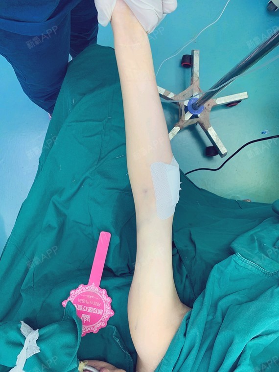 效果不错,胳膊细了好多,整个人看起来都有一点纤细的味道了