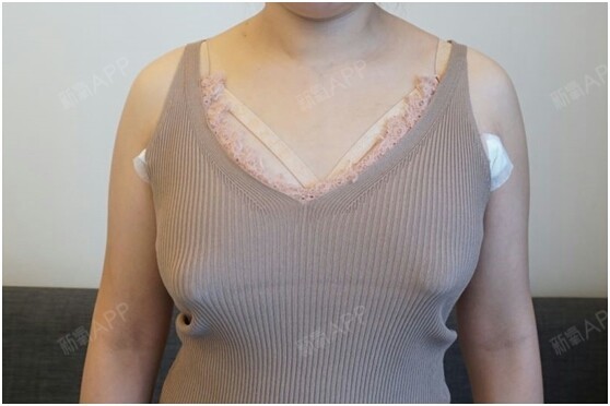 乳房干瘪一层皮图片