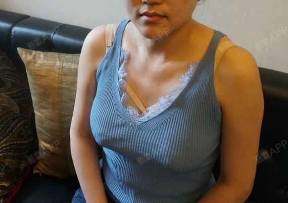 胸部肿胀情况好了很多,不过还是有点肿胀的,得再过段_圈子-新氧美容