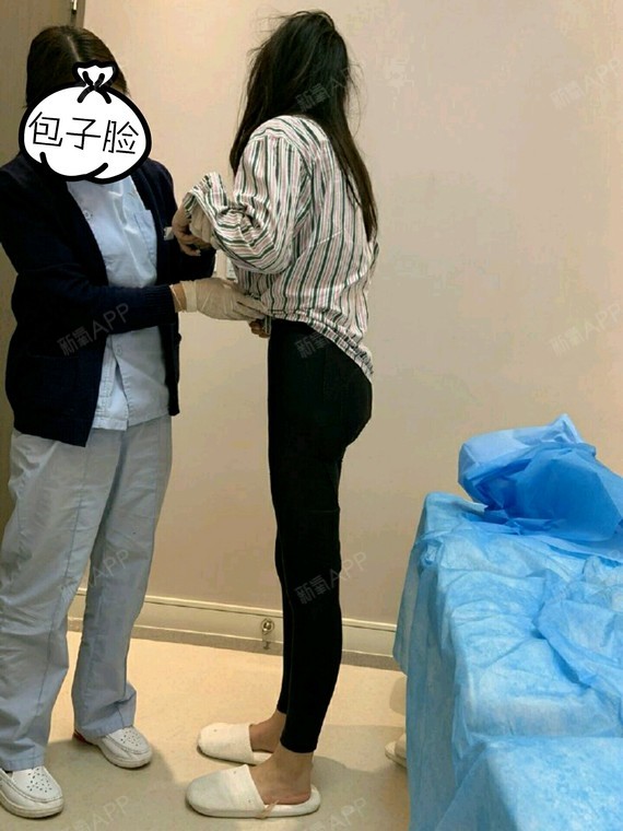 冷冻溶脂瘦背部