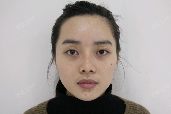 我的脸型属于较窄的那种,鼻梁不高挺大学毕业前都没有感觉,整体五官拼