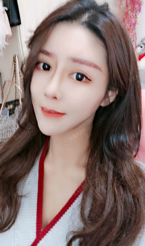 【韩式小翘鼻第80天】很长时间没哟更新日记啦,现在鼻子已经