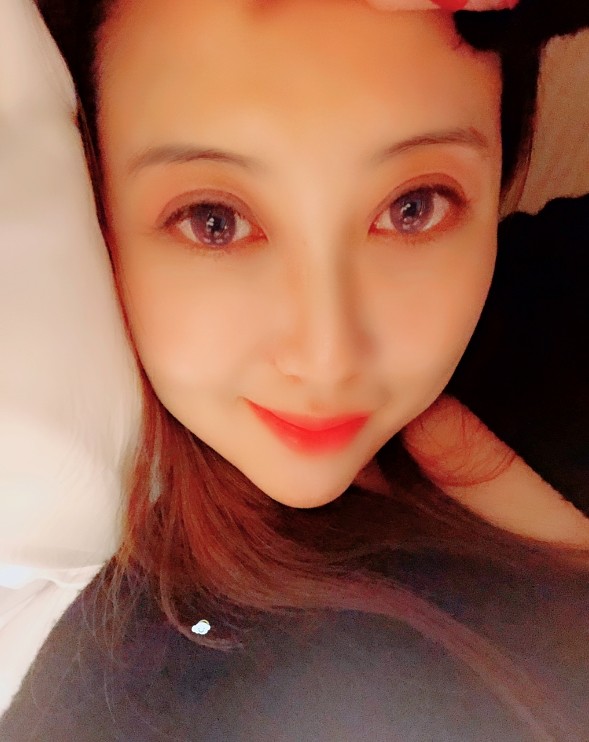 西安尤美醫療美容埋線提升怎麼樣_恢復過程_效果如何_氧氣fm6vk整形