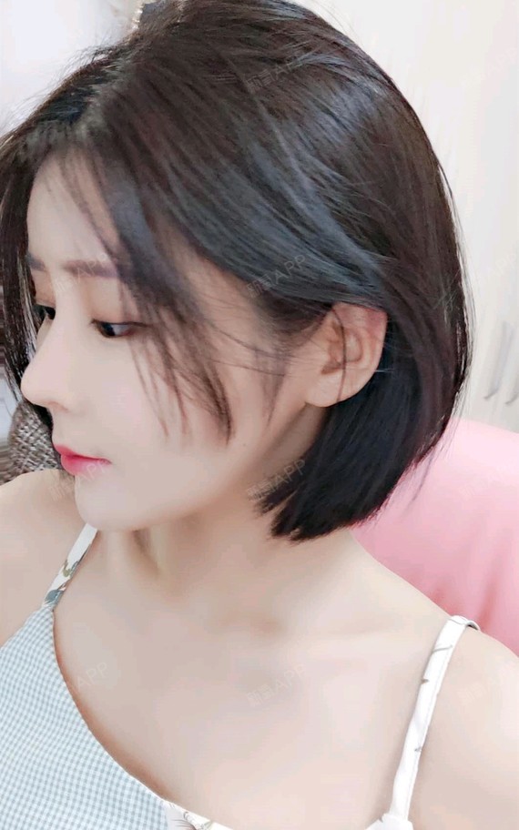 【韩式小翘鼻第200天】做的鼻部多项,鼻梁和鼻尖都有_圈子-新氧美容