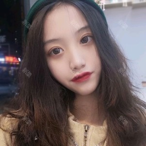 【玻尿酸】润百颜 润百颜白紫 1ml ,[大家都在买] 人气款润百颜白紫1