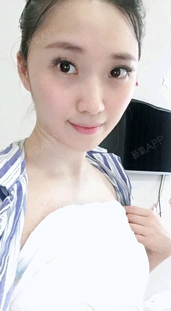 佛山假体隆胸好不好_效果图_氧气6h9zz假体隆胸术后第5天_新氧美容