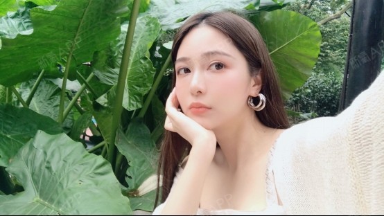 星妍医美 全脸埋线提升】超过25脸上的肉一直很松_圈子-新氧美容整形