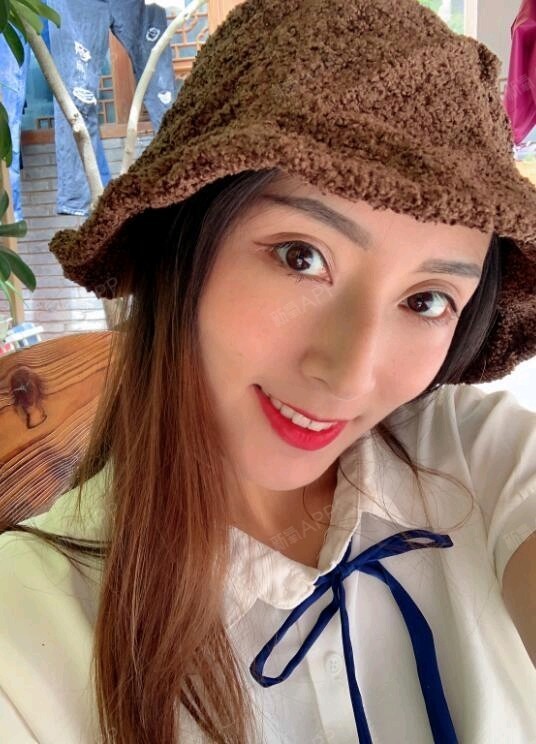 星妍医美 全脸埋线提升】半个月啦,现在处在恢复期_圈子-新氧美容整形