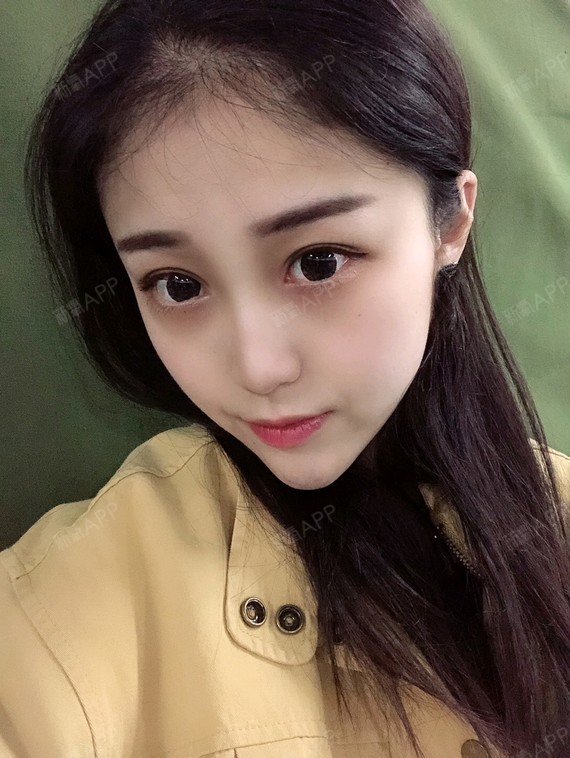 【星妍医美 眼部多项】我来给大家分享我近期的照片了_圈子-新氧美容