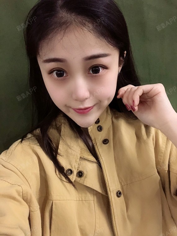 【星妍医美 眼部多项】我来给大家分享我近期的照片了_圈子-新氧美容