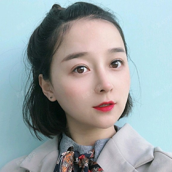 手术缩鼻翼好不好_效果图_氧气l907s手术缩鼻翼术后第206天_新氧美容