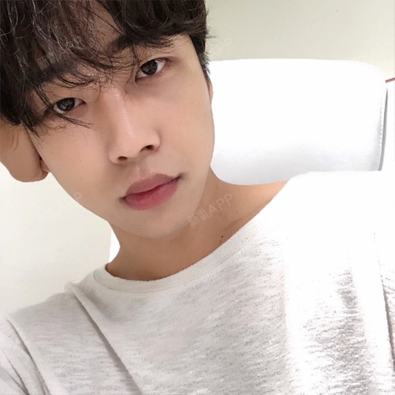 埋线双眼皮好不好_效果图_叫我欧巴埋线双眼皮术后第210天_新氧美容