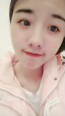 贵阳注射瘦脸好不好_效果图_氧气0x7jj注射瘦脸术后第33天_新氧美容