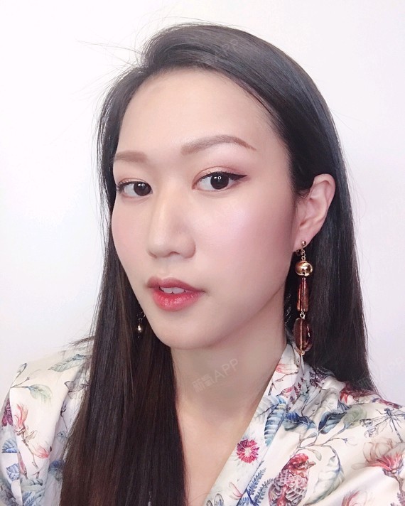 【星妍医美 去眼袋】第33天.就算是高清怼脸的自拍_圈子-新氧美容整形