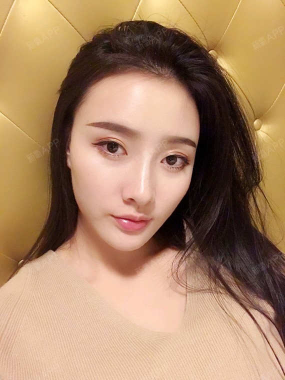 玻尿酸填充卧蚕