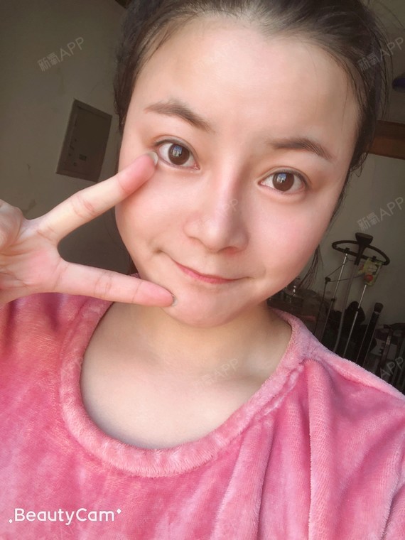 苏州鼻部多项好不好_效果图_cool123鼻部多项术后第60天_新氧美容整形