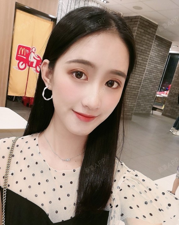 【星妍医美 双眼皮】两个多月了,恢复的真的很自然,_圈子-新氧美容