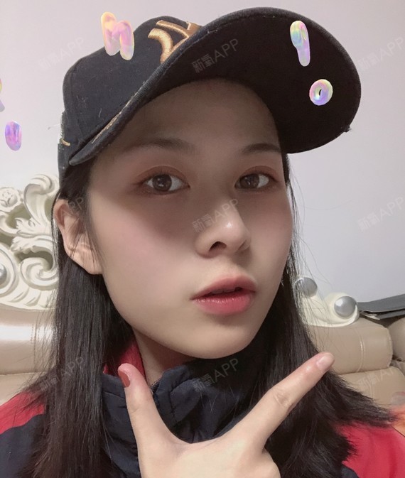 【星妍医美 鼻部多项】姐妹们我又来啦~这期间鼻子没有_圈子-新氧美容