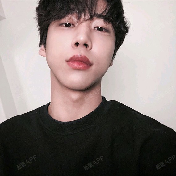 埋线双眼皮好不好_效果图_叫我欧巴埋线双眼皮术后第276天_新氧美容