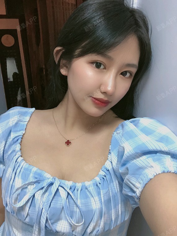 贵阳假体隆胸好不好_效果图_是怎扰假体隆胸术后第280天_新氧美容整形
