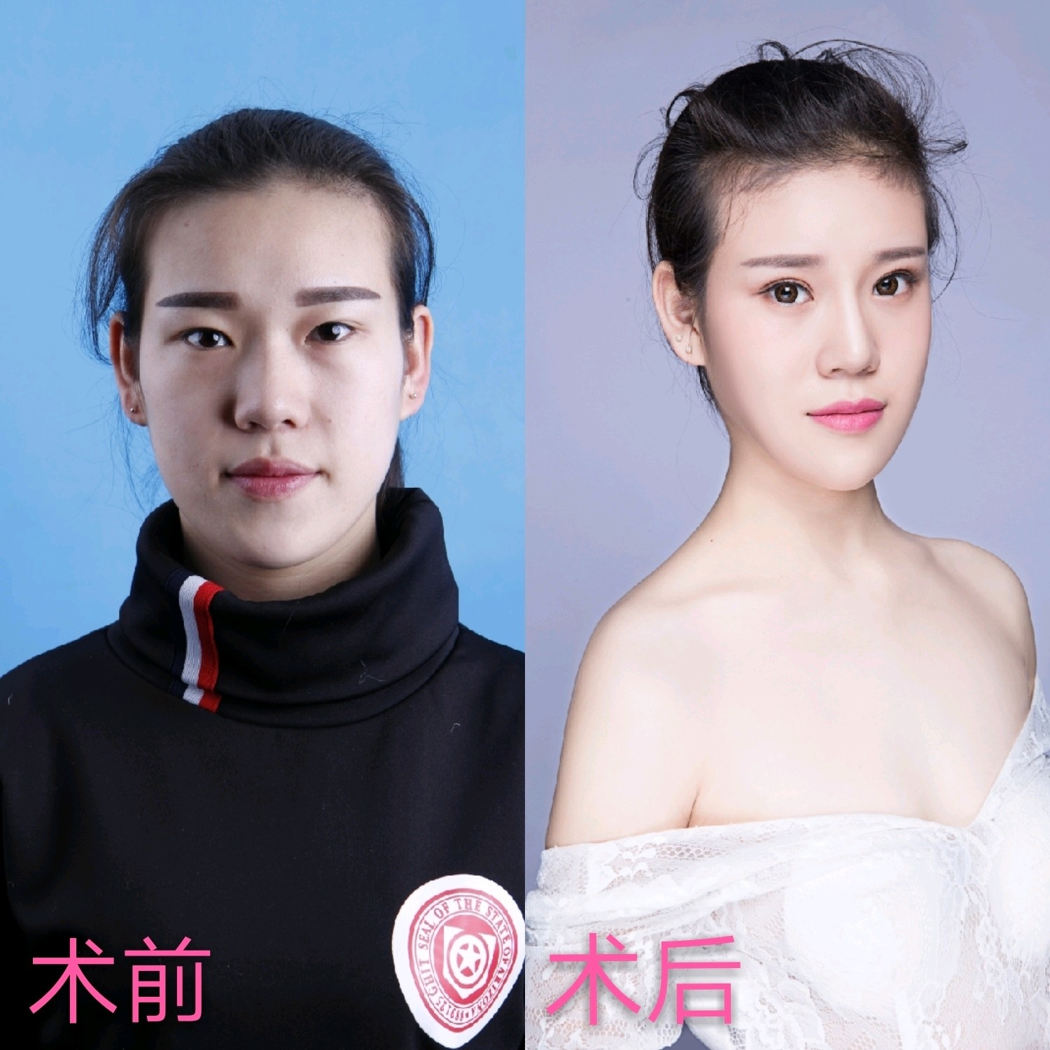 变成美_圈子-新氧美容整形