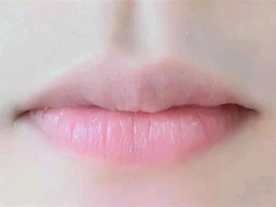 厚唇改薄变化这么大,你还在等什么?好看的唇型不仅可_圈子-新氧美容整