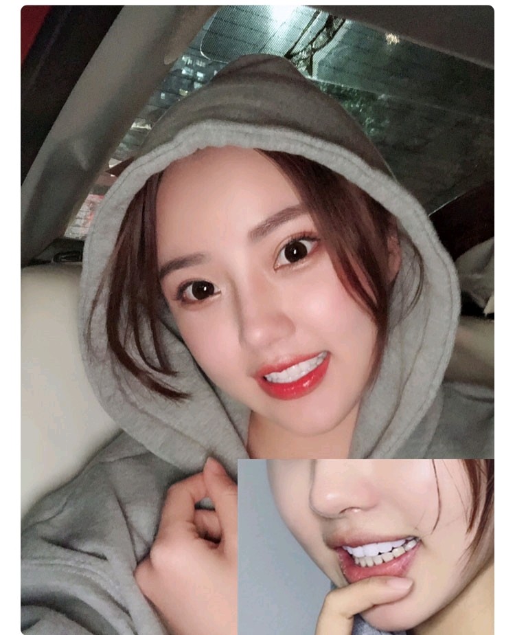 就露出洁白而整齐的牙齿