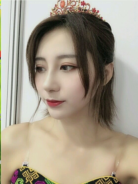 隆鼻5年,我需要换假体吗?现今隆鼻手术越来越