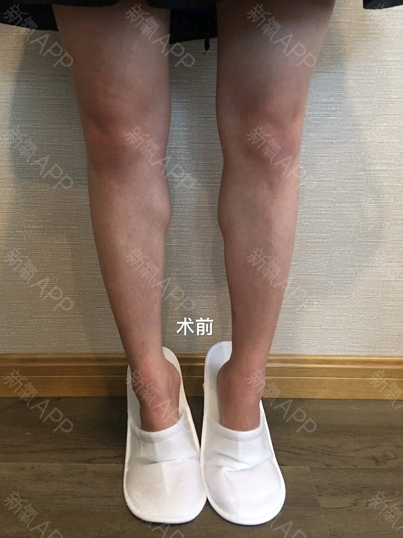 小鸟腿是怎么样练成的