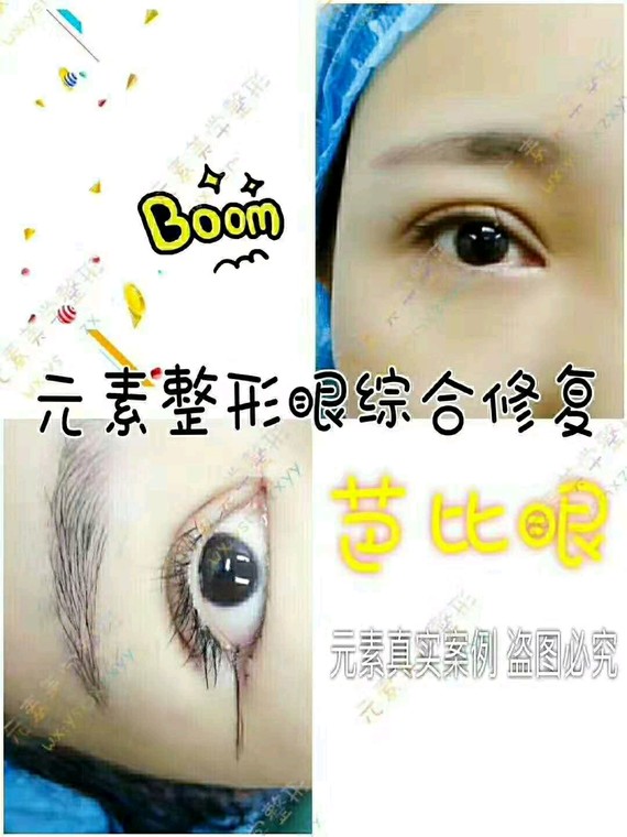 眼睛对于颜值的重要性毋庸置疑一次成功的双眼