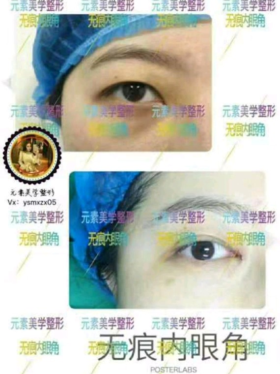眼睛对于颜值的重要性毋庸置疑一次成功的双眼