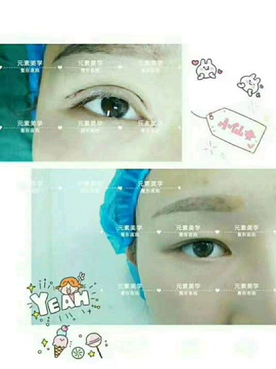 眼睛对于颜值的重要性毋庸置疑一次成功的双眼