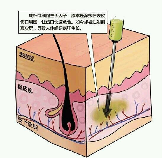 近期,想做生长因子取出的_圈子-新氧美容整形