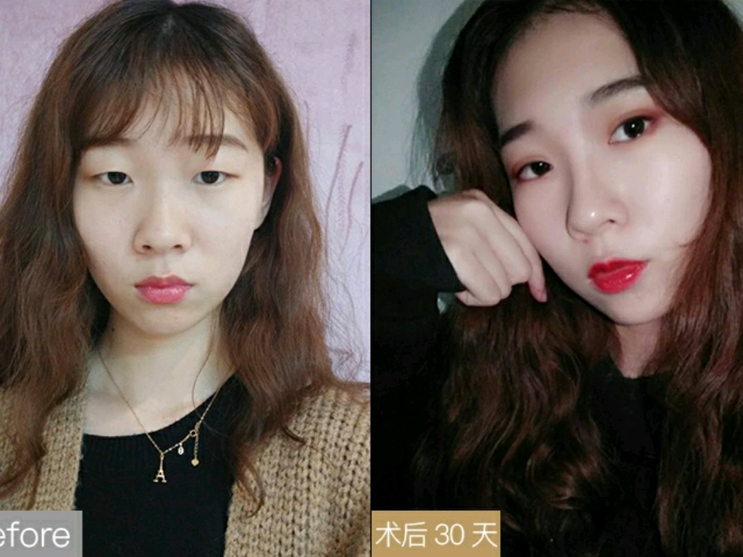 美杜莎综合美眼