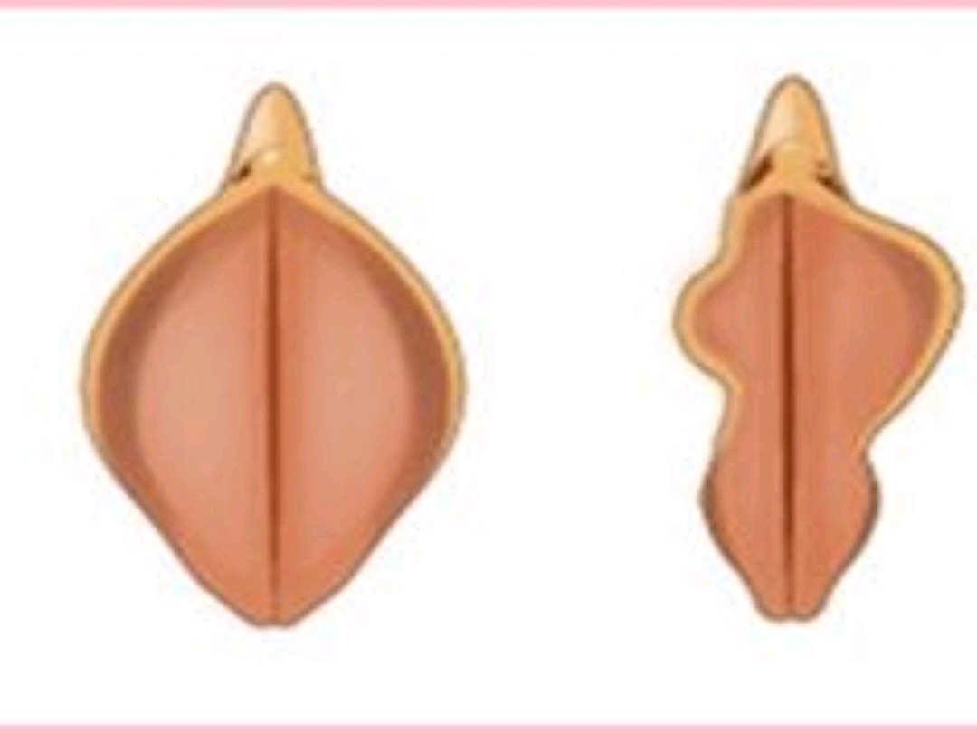 小阴唇---你了解多少?